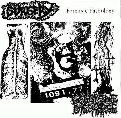 Gangrene Discharge : Forensic Pathology